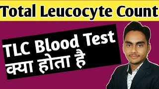 TLC blood test  total leucocyte count test in hindi [upl. by Marciano]