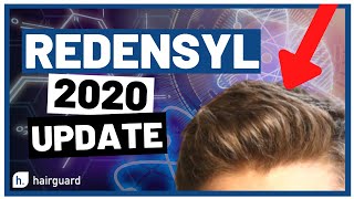 Redensyl 2020 Updates For YOUR Hair GROWTH [upl. by Nosimaj]