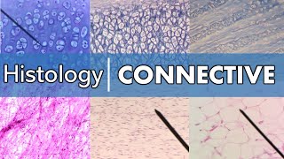 Histology  Connective Tissue [upl. by Ambie300]