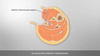 AO Tibia and fibula–Malleolar fracture [upl. by Brice]