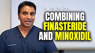 Combining Finasteride and Minoxidil Therapies [upl. by Flanagan393]