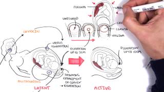 Obstetrics  Stages of Labour [upl. by Euqinay893]