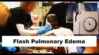 Flash Pulmonary Edema Emergency [upl. by Annavoeg866]