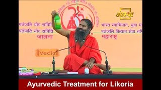 Ayurvedic Treatment for White Discharge लिकोरिया [upl. by Alket]