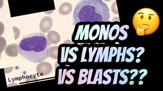 How I distinguish between Lymphocytes vs Monocytes [upl. by Cybil]