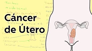 Cáncer de mama descubren cómo curarlo sin cirugía [upl. by Aeneg]