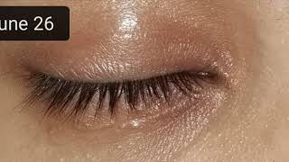 Castor Oil Does it help eyelashes grow longer  3months with pictures [upl. by Ramej]